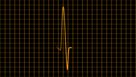 Lazo-De-Pantalla-De-Osciloscopio-De-Cardiograma-Cardiograma-4k